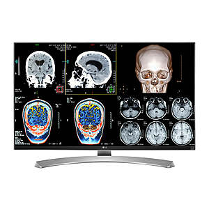 LG 4K 27" 8MP Color Clinical Review Medical Display Monitor (27M-W) up to 90% off